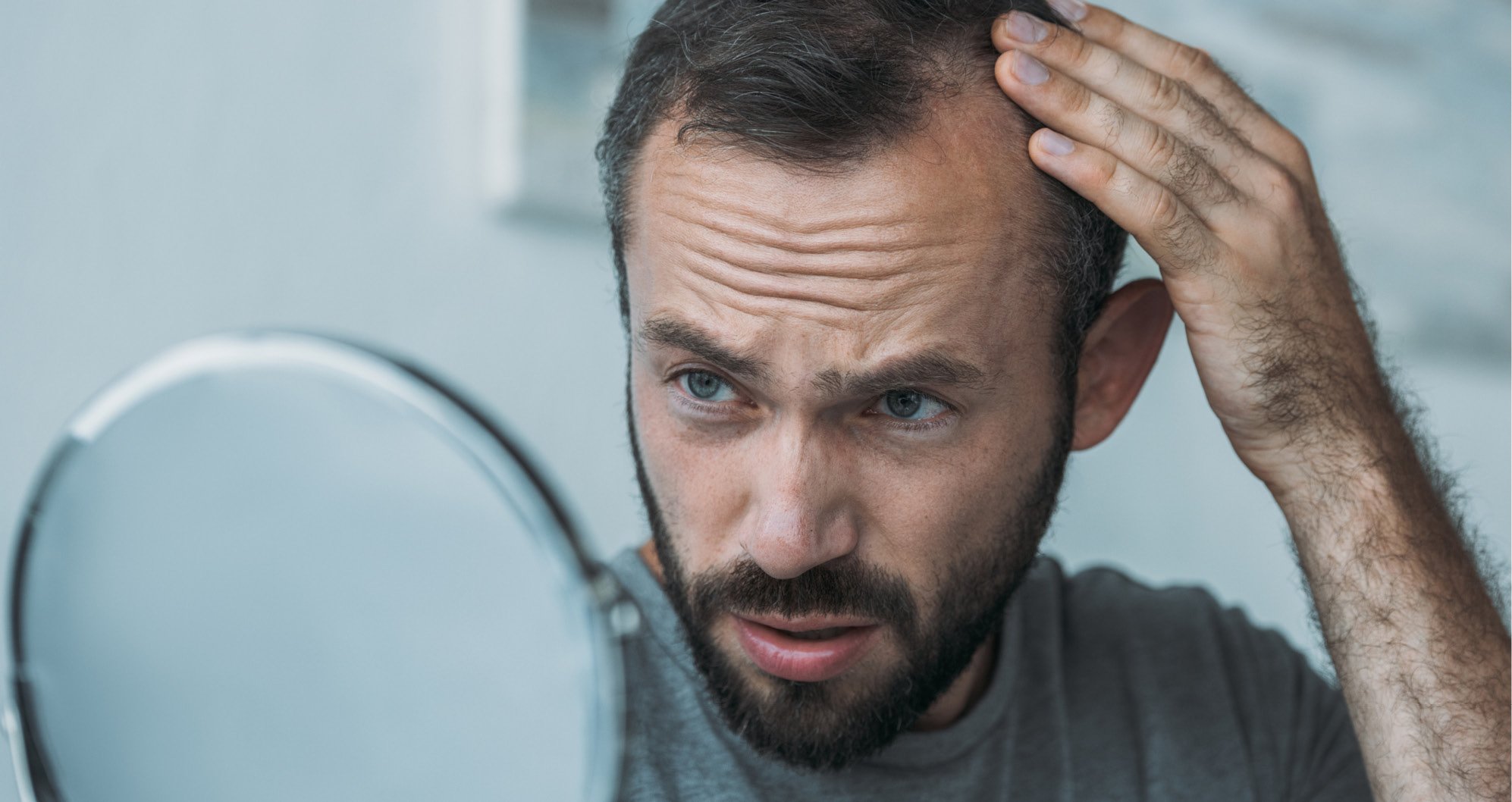 Cosmetic Services - man holding mirror and looking in it with a concerned face about his hair loss